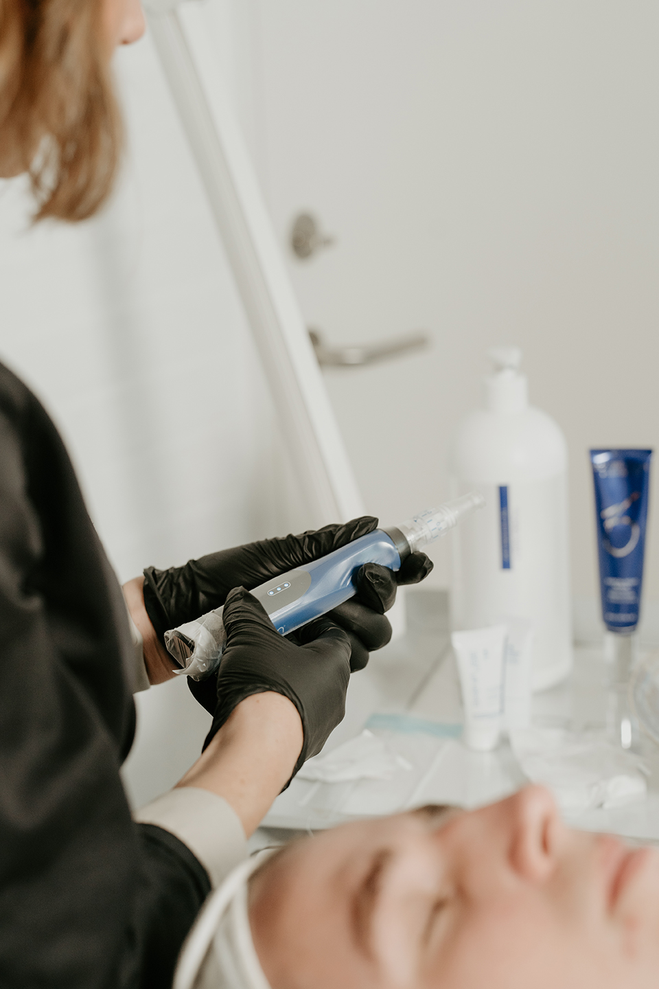 SkinPen-York-Skin-Clinic